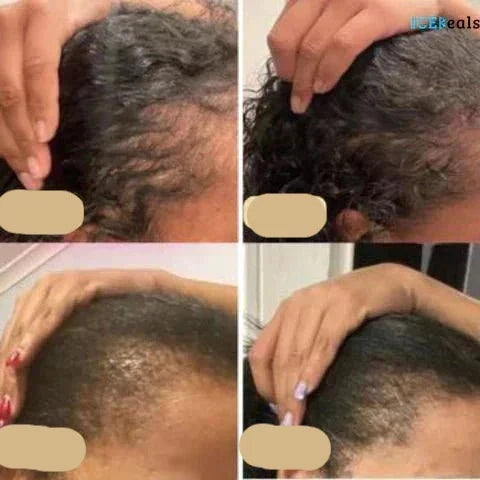Huile Végétalienne pour la Croissance des Cheveux | Booster Naturel pour une Croissance Saine des Cheveux