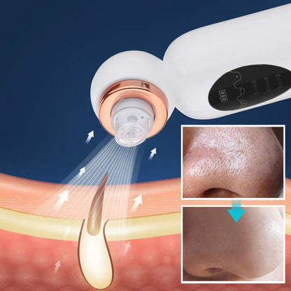 Extracteur de Points Noirs et Appareil D' Hydrodermabrasion