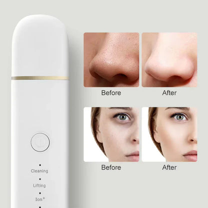 Gommage de la Peau pour un Nettoyage en Profondeur