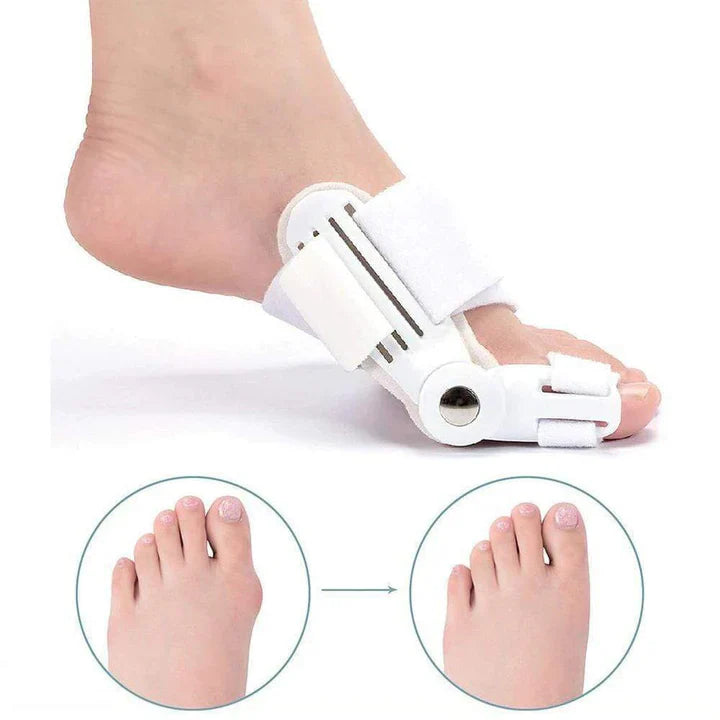 Attelle de Correction de L' Hallux Valgus (1 Paire)